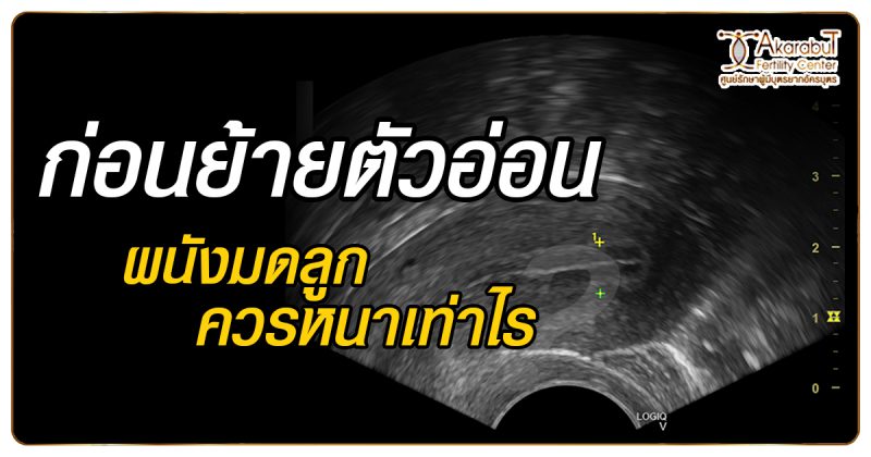 ก่อนย้ายตัวอ่อนผนังมดลูกควรหนาเท่าไหร่